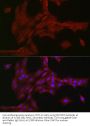 Neurogenic Locus Notch Homolog Protein 3 (NOTCH3) Antibody