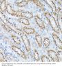 Protein Phosphatase 2 Catalytic Subunit Beta (PPP2CB) Antibody