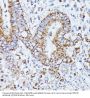 Protein Phosphatase 2 Catalytic Subunit Beta (PPP2CB) Antibody