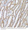 Protein Phosphatase 2 Catalytic Subunit Beta (PPP2CB) Antibody