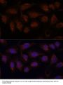 Protein Phosphatase 2 Catalytic Subunit Beta (PPP2CB) Antibody
