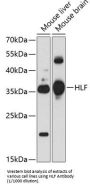 Hepatic Leukemia Factor (HLF) Antibody