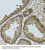 Cytochrome B-C1 Complex Subunit 1, Mitochondrial (UQCRC1) Antibody