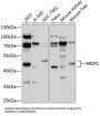 WNT1 Inducible Signaling Pathway Protein 1 / WISP1 (CCN4) Antibody
