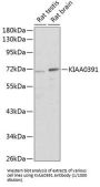 Mitochondrial Ribonuclease P Catalytic Subunit (KIAA0391) Antibody