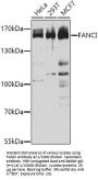 Fanconi Anemia Group I Protein (FANCI) Antibody