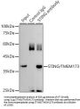 Stimulator of Interferon Genes Protein / TMEM173 (STING1) Antibody