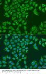 Aldehyde Dehydrogenase X, Mitochondrial (ALDH1B1) Antibody