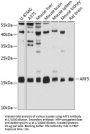 ADP-Ribosylation Factor 5 (ARF5) Antibody