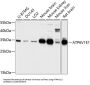 V-Type Proton ATPase Subunit E 1 (ATP6V1E1) Antibody