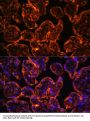 Ectonucleoside Triphosphate Diphosphohydrolase 1 (ENTPD1) Antibody