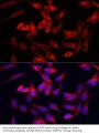 Collagen Type III Alpha 1 (COL3A1) Antibody