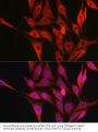 Collagen Type III Alpha 1 (COL3A1) Antibody