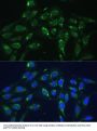 Cytochrome C Oxidase Subunit 6A1 (COX6A1) Antibody