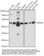 Eukaryotic Initiation Factor 4A-II (EIF4A2) Antibody