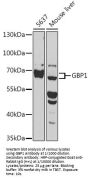 Guanylate-Binding Protein 1 (GBP1) Antibody
