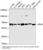 G Protein-Coupled Receptor Kinase 5 (GRK5) Antibody