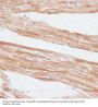 G Protein-Coupled Receptor Kinase 5 (GRK5) Antibody