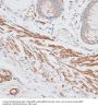 G Protein-Coupled Receptor Kinase 5 (GRK5) Antibody