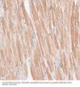 G Protein-Coupled Receptor Kinase 5 (GRK5) Antibody