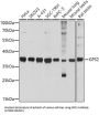 G Protein Pathway Suppressor 2 (GPS2) Antibody