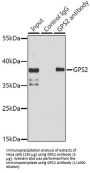 G Protein Pathway Suppressor 2 (GPS2) Antibody
