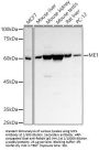 Malic Enzyme 1 (ME1) Antibody