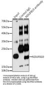 NADH Ubiquinone Oxidoreductase Subunit B10 (NDUFB10) Antibody