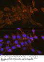 Oxysterol Binding Protein 1 (OSBP) Antibody