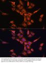 Prefoldin Subunit 5 (PFDN5) Antibody