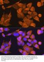 Prefoldin Subunit 5 (PFDN5) Antibody