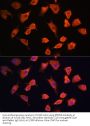 Prefoldin Subunit 5 (PFDN5) Antibody