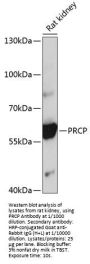 Prolylcarboxypeptidase (PRCP) Antibody