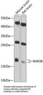 RAP2B, Member of RAS Oncogene Family (RAP2B) Antibody