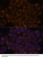 Ribosomal Protein L23A (RPL23A) Antibody