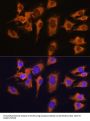 Solute Carrier Family 20 Member 1 (SLC20A1) Antibody