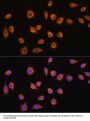 Solute Carrier Family 20 Member 1 (SLC20A1) Antibody