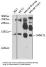 Dynein Light Chain Tctex-Type 1 (DYNLT1) Antibody
