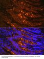 Talin-1 (TLN1) Antibody