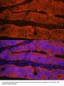 Talin-1 (TLN1) Antibody