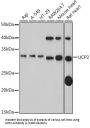 Mitochondrial Uncoupling Protein 2 (UCP2) Antibody