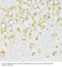 Valyl tRNA Synthetase (VARS) Antibody