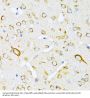 Valyl tRNA Synthetase (VARS) Antibody