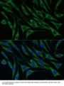 Valyl tRNA Synthetase (VARS) Antibody