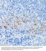 Interferon Induced Transmembrane Protein 1 (IFITM1) Antibody
