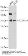 Solute Carrier Family 25 Member 15 (SLC25A15) Antibody