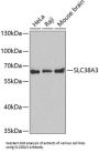 Solute Carrier Family 38 Member 3 (SLC38A3) Antibody