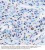 Cleavage And Polyadenylation Specificity Factor Subunit 5 (NUDT21) Antibody
