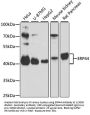 Endoplasmic Reticulum Protein 44 (ERP44) Antibody