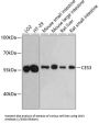 Carboxylesterase 3 (CES3) Antibody